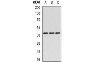 Western blot analysis of CD88 expression in A549 (A), mouse brain (B), rat spleen (C) whole cell lysates. (C5AR1 antibody  (N-Term))