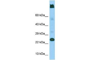 Western Blotting (WB) image for anti-Lymphocyte Antigen 6 Complex, Locus G5C (LY6G5C) (C-Term) antibody (ABIN2444645) (LY6G5C antibody  (C-Term))