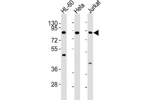 All lanes : Anti-IKK beta Antibody at 1:4000 dilution Lane 1: HL-60 whole cell lysates Lane 2: Hela whole cell lysates Lane 3: Jurkat whole cell lysates Lysates/proteins at 20 μg per lane. (IKBKB antibody)