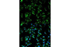 Immunofluorescence analysis of HeLa cell using TPM3 antibody. (TPM3 antibody)