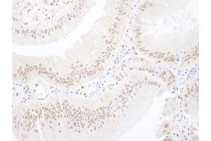 Immunohistochemistry (IHC) image for anti-Myocyte Enhancer Factor 2A (MEF2A) (AA 175-225) antibody (ABIN7454560) (MEF2A antibody  (AA 175-225))