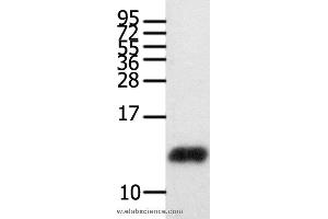 Western blot analysis of Human brain glioma tissue , using CCL28 Polyclonal Antibody at dilution of 1:450