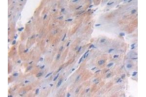 Detection of LTBP1 in Mouse Heart Tissue using Polyclonal Antibody to Latent Transforming Growth Factor Beta Binding Protein 1 (LTBP1) (LTBP1 antibody  (AA 1415-1712))