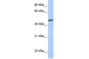 CALCRL antibody used at 1 ug/ml to detect target protein. (CALCRL antibody  (N-Term))