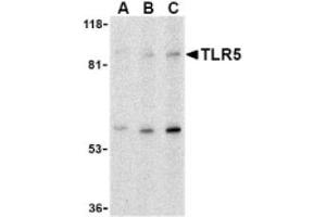 Image no. 1 for anti-Toll-Like Receptor 5 (TLR5) (C-Term) antibody (ABIN265142) (TLR5 antibody  (C-Term))