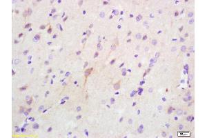 Formalin-fixed and paraffin embedded rat brain labeled with Anti Phospho-PKR (Thr446 + Thr451) Polyclonal Antibody (ABIN744818), Unconjugated at 1:200, followed by conjugation to the secondary antibody and DAB staining (EIF2AK2 antibody  (pThr446, pThr451))