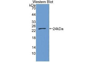 Western Blotting (WB) image for anti-Growth Arrest-Specific 6 (GAS6) (AA 136-311) antibody (ABIN1172547) (GAS6 antibody  (AA 136-311))