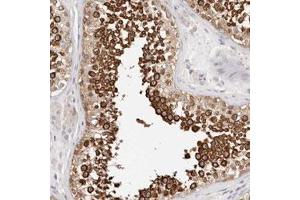 Immunohistochemical staining (Formalin-fixed paraffin-embedded sections) of human testis with MLLT4 polyclonal antibody  shows strong cytoplasmic positivity in cells in seminiferous ducts. (Afadin antibody)