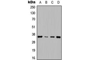 Western blot analysis of Cyclin D1 expression in HepG2 (A), NIH3T3 (B), rat muscle (C), rat kidney (D) whole cell lysates. (Cyclin D1 antibody  (Center))