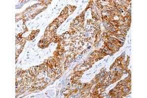 Immunohistochemistry (IHC) image for anti-Gastrin-Releasing Peptide Receptor (GRPR) (AA 235-384) antibody (ABIN6219927) (GRPR antibody  (AA 235-384))