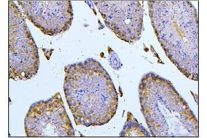 IHC analysis of BubR1/BUB1B using anti-BubR1/BUB1B antibody (ABIN7600962).