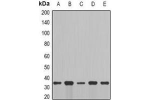 Western blot analysis of Cyclin C expression in MCF7 (A), NIH3T3 (B), mouse brain (C), mouse lung (D), rat liver (E) whole cell lysates.