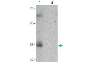 Western blot analysis of FOXD4L1 in A-20 cell lysate with FOXD4L1 polyclonal antibody  at 1 ug/mL in (lane 1) the absence and (lane 2) the presence of blocking peptide. (FOXD4L1 antibody  (C-Term))