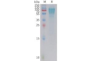 Cynomolgus GC Protein, His Tag on SDS-PAGE under reducing condition.