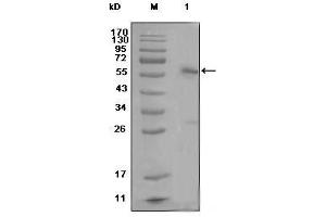 Western Blot showing ESR1 antibody used against MCF-7 cell lysate (1) (Estrogen Receptor alpha antibody)