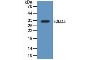 Detection of Recombinant TrxR1, Rat using Polyclonal Antibody to Thioredoxin Reductase 1 (TXNRD1) (TXNRD1 antibody  (AA 208-433))