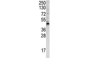 Western Blotting (WB) image for anti-Wingless-Type MMTV Integration Site Family, Member 4 (WNT4) (AA 242-269) antibody (ABIN3029632)