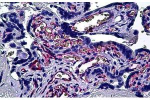 Immunohistochemistry (Formalin-fixed Paraffin-embedded Sections) (IHC (fp)) image for anti-Platelet/endothelial Cell Adhesion Molecule (PECAM1) (AA 29-739) antibody (ABIN626055)