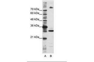 Image no. 2 for anti-serine/arginine-Rich Splicing Factor 10 (SRSF10) (C-Term) antibody (ABIN6736232) (SRSF10 antibody  (C-Term))