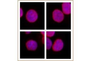 SMARCC1 / BAF155 antibody (pAb) tested by Immunofluorescence. (SMARCC1 antibody  (N-Term))
