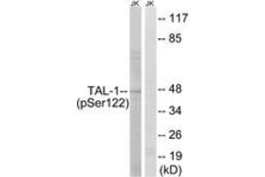Western blot analysis of extracts from Jurkat cells treated with PMA 125ng/ml 30', using TAL-1 (Phospho-Ser122) Antibody. (TAL1 antibody  (pSer122))