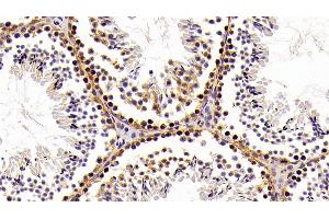 Detection of HMGB1 in Mouse Testis Tissue using Polyclonal Antibody to High Mobility Group Protein 1 (HMGB1) (HMGB1 antibody  (AA 1-215))