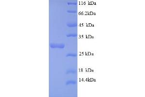 SDS-PAGE (SDS) image for Androgen-Induced 1 (AIG1) (AA 60-87), (partial) protein (GST tag) (ABIN4974690)