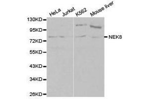 Western Blotting (WB) image for anti-NIMA-Related Kinase 8 (NEK8) antibody (ABIN1873874) (NEK8 antibody)