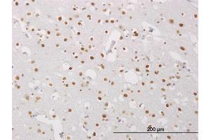 Immunoperoxidase of monoclonal antibody to MECP2 on formalin-fixed paraffin-embedded human cerebral cortex. (MECP2 antibody  (AA 81-170))