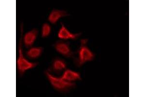 ABIN6276025 staining Hela by IF/ICC. (GPRC5D antibody  (Internal Region))