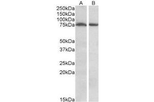AP23695PU-N STK39 / SPAK Antibody of Mouse (A) and Rat (B) Brain (35µg protein in RIPA buffer). (STK39 antibody  (Internal Region))