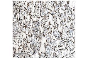 IHC analysis of DDX5 using anti-DDX5 antibody (ABIN7602561).
