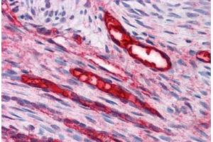 Immunohistochemistry (Formalin-fixed Paraffin-embedded Sections) (IHC (fp)) image for anti-Budding Uninhibited By Benzimidazoles 3 Homolog (Yeast) (BUB3) (AA 267-327) antibody (ABIN604943)