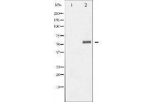 Western blot analysis of Elk1 phosphorylation expression in UV treated Jurkat whole cell lysates,The lane on the left is treated with the antigen-specific peptide. (ELK1 antibody  (pSer389))