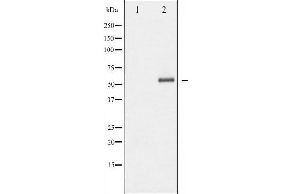 ELK1 antibody  (pSer389)