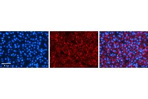 Rabbit Anti-PDLIM5 Antibody   Formalin Fixed Paraffin Embedded Tissue: Human Liver Tissue Observed Staining: Cytoplasm in hepatocytes Primary Antibody Concentration: 1:100 Other Working Concentrations: N/A Secondary Antibody: Donkey anti-Rabbit-Cy3 Secondary Antibody Concentration: 1:200 Magnification: 20X Exposure Time: 0. (PDLIM5 antibody  (Middle Region))
