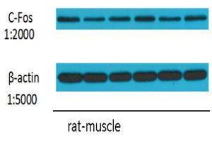 Western Blot (WB) analysis: Please contact us for more details. (c-FOS antibody)
