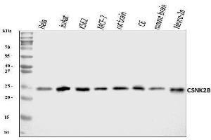 Western blot analysis of CSNK2B using anti-CSNK2B antibody (ABIN7599092).