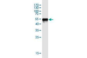 Western Blot detection against Immunogen (48. (TCEAL3 antibody  (AA 1-200))