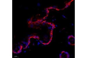 Immunofluorescence of paraffin embedded rat skin using collagen alpha-1 (V) (ABIN7073547) at dilution of 1: 1500 (400x lens) (Collagen Type V antibody)
