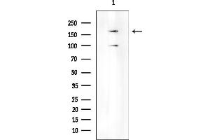 Western blot analysis of lysates from PC12 cells, using LRP6 Mouse Monoclonal Antibody at 1/1000 dilution.