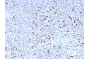 Immunohistochemistry (IHC) image for anti-Granzyme B (GZMB) (AA 73-187) antibody (ABIN6939591)