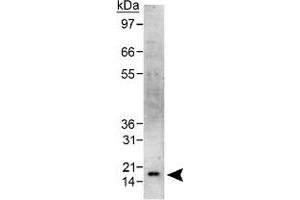Western blot analysis of CBX5 in HeLa whole cell lysate using CBX5 polyclonal antibody . (CBX5 antibody  (AA 1-100))