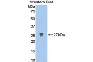 Western Blotting (WB) image for anti-Matrix Metalloproteinase 2 (MMP2) (AA 445-660) antibody (ABIN1078307) (MMP2 antibody  (AA 445-660))