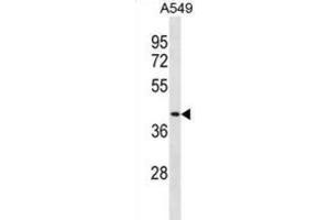 Western Blotting (WB) image for anti-Dipeptidase 1 (Renal) (DPEP1) antibody (ABIN3001069) (DPEP1 antibody)
