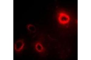Immunofluorescent analysis of RPLP1 staining in SW480 cells. (RPLP1 antibody)