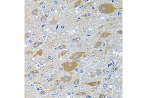 Immunohistochemistry of paraffin-embedded rat brain using EIF2S3 antibody (ABIN6130363, ABIN6140051, ABIN6140052 and ABIN6222259) at dilution of 1:100 (40x lens).
