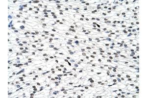 SURF6 antibody was used for immunohistochemistry at a concentration of 4-8 ug/ml to stain Myocardial cells (arrows) in Human Heart.