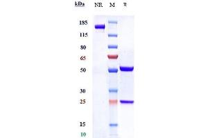 Anti-SLC44A4 Reference Antibody (ASG-5ME) on SDS-PAGE under reducing (R) condition.