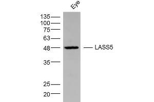 LASS5 antibody  (AA 101-200)